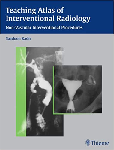 Teaching Atlas of Interventional Radiology: Non-Vascular Interventional Procedures - Orginal Pdf